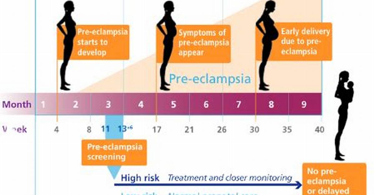How Quickly Can Preeclampsia Develop