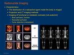 How Radionuclide Imaging Work?