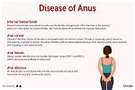 How Sensitive Is the Anus