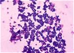 How Staphylococcus Aureus Spread?