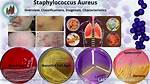 How Staphylococcus Is Treated?