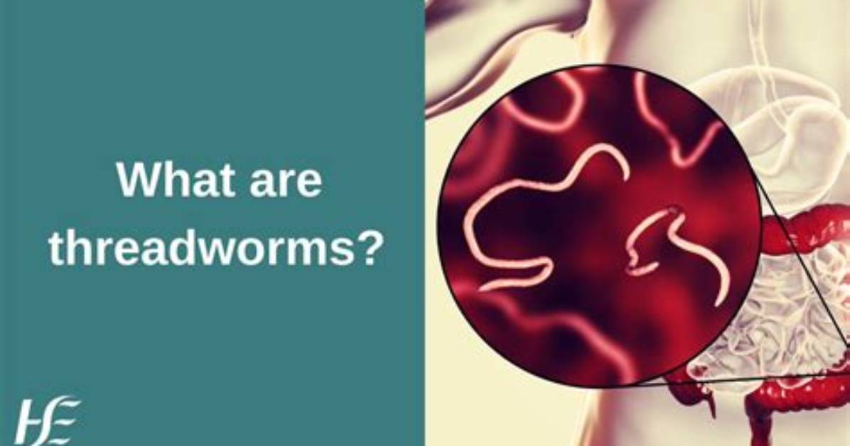 How Threadworms Are Caught?