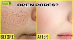 How to Close Pores?