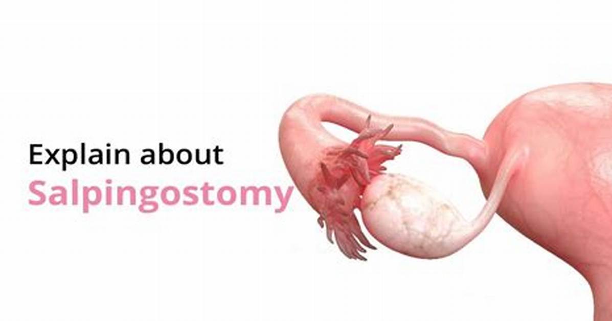 How to Code Salpingostomy?