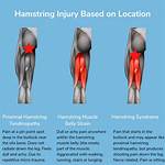 How to Fix Overstretched Hamstring?