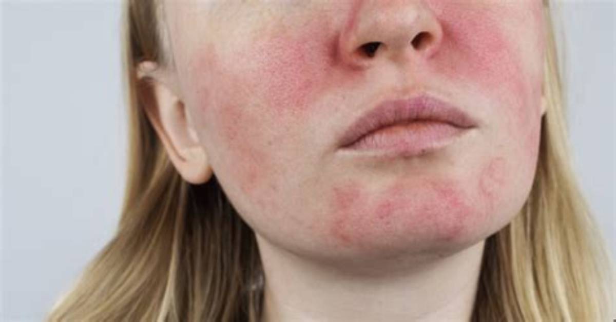 How to Flush Face?
