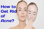【How-To】How to Get Rid of Burnt Hair Smell