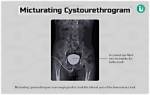 How to Perform Micturating Cystourethrogram?