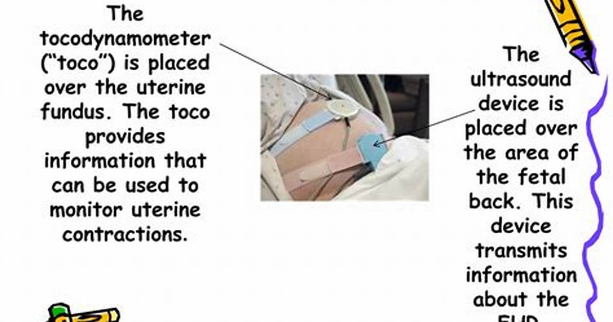 How to Read a Tocodynamometer?