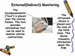 How to Read a Tocodynamometer?