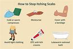 How to Stop Itching?