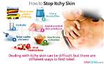 How to Stop Something Itching?