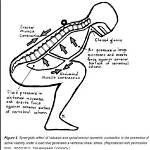 How Valsalva Decrease Preload?