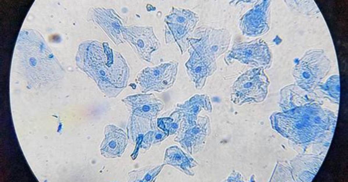 Human Cheek Cell Under Microscope