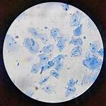 Human Cheek Cell Under Microscope