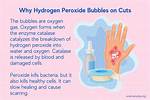 Hydrogen Peroxide Bubble