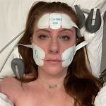 I Tried Emface, the New Device for Needleless Filler