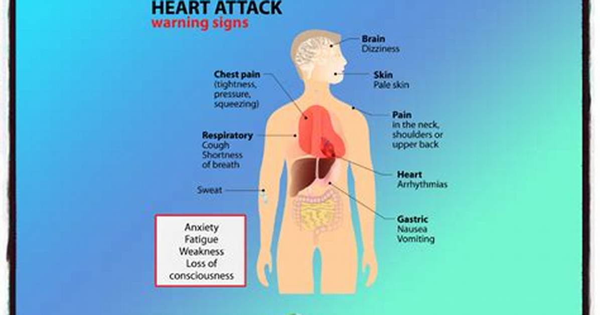 Icd 10 Code for Nstemi