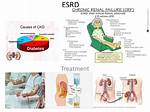 Icd 10 Esrd