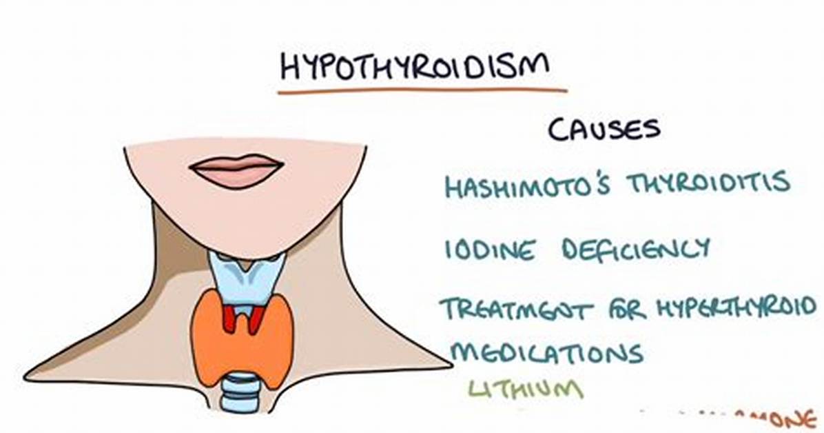 Icd 10 Hyperthyroidism
