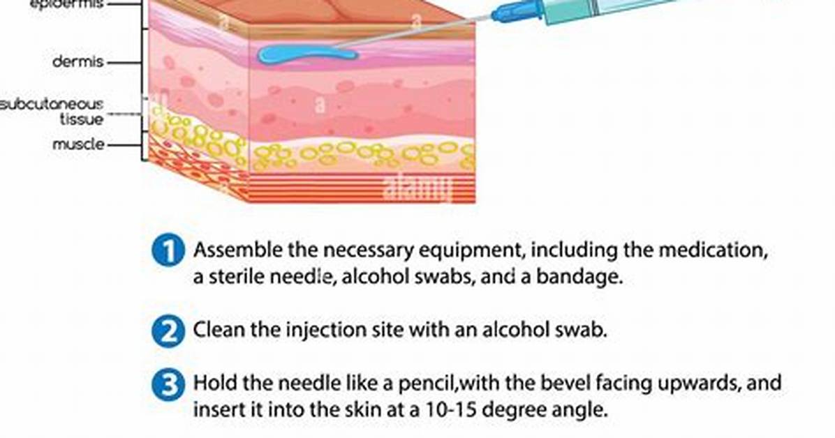 Id Injection