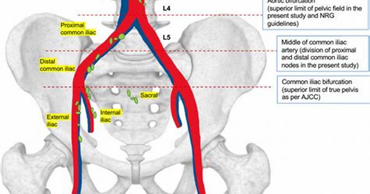 Iliac Nodes