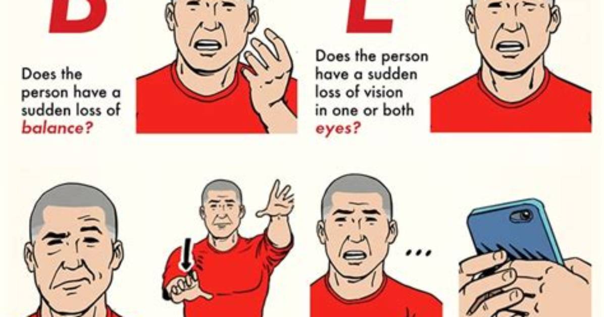 In Recognizing a Stroke?