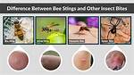 Insect That Stings
