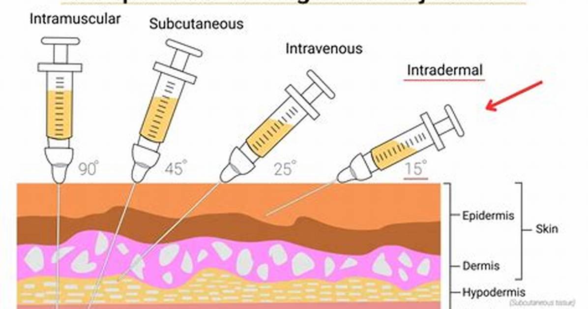 Intradermal Injection Angle
