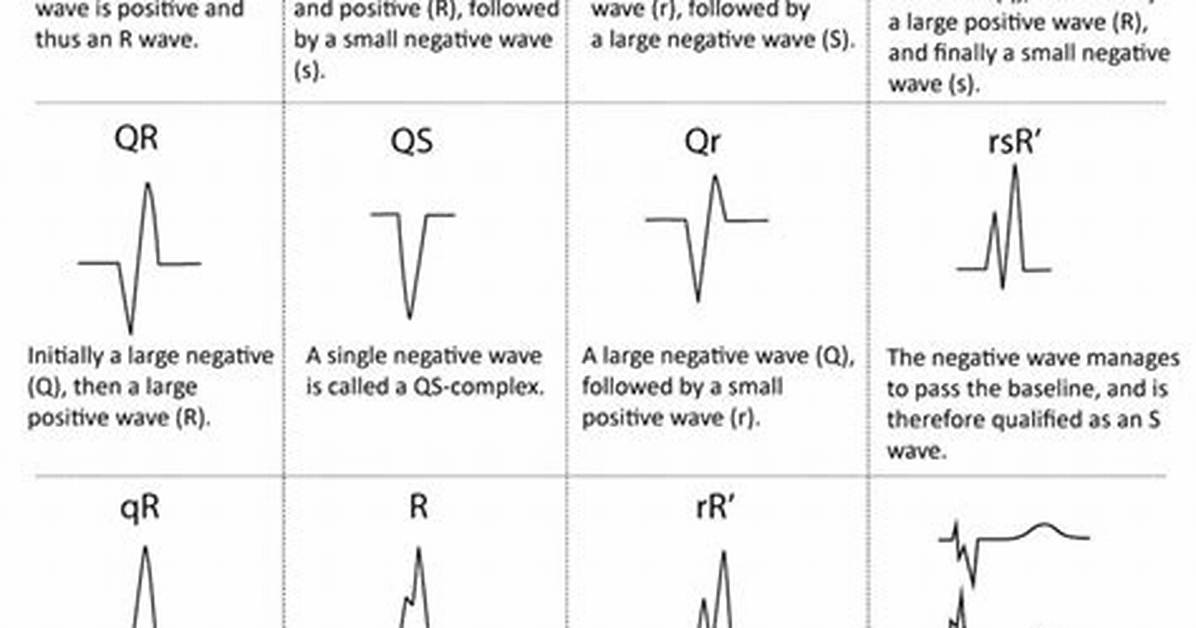 Inverted Qrs Complex