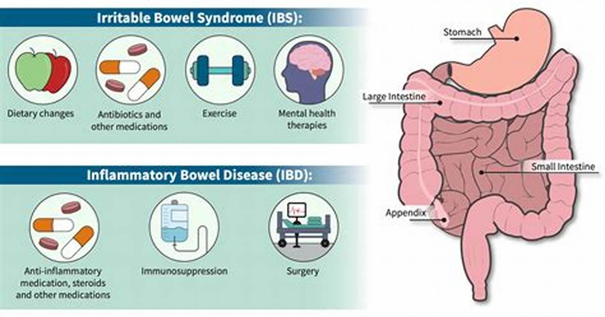 Irritable Bowel Syndrome (Ibs) Treatment