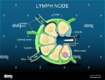 Is a Lymph Node?