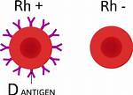 Is a- Rh Negative?