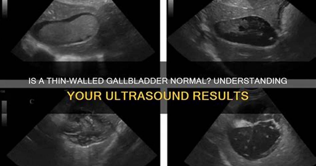 Is a Thin Walled Gallbladder Normal?