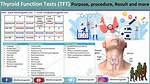 Is a Thyroid Function Test?