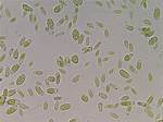 Is Algae a Bacteria?