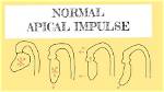 Is Apical Impulse Normal