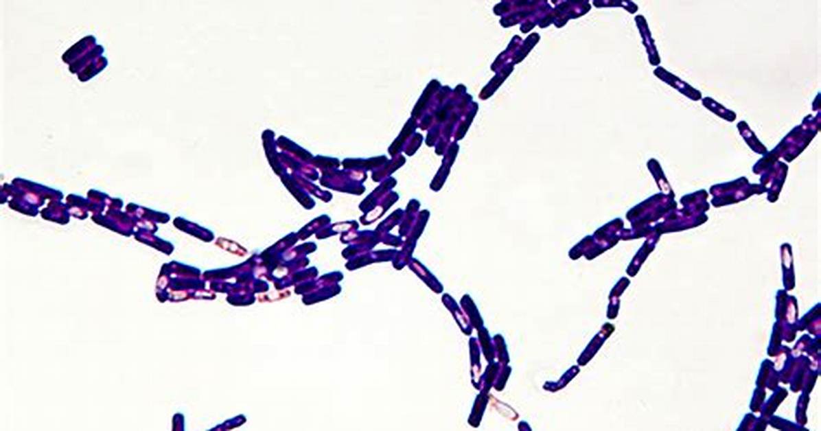Is Bacillus Gram Variable?