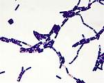 Is Bacillus Gram Variable?