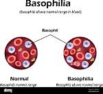 Is Basophils 0 Normal?