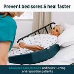 Is Bed Sores Spreadable?