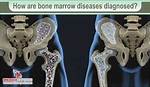 Is Bone Marrow Bad