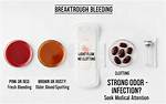 Is Breakthrough Bleeding Common?