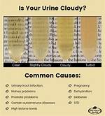 Is Cloudy Urine Normal