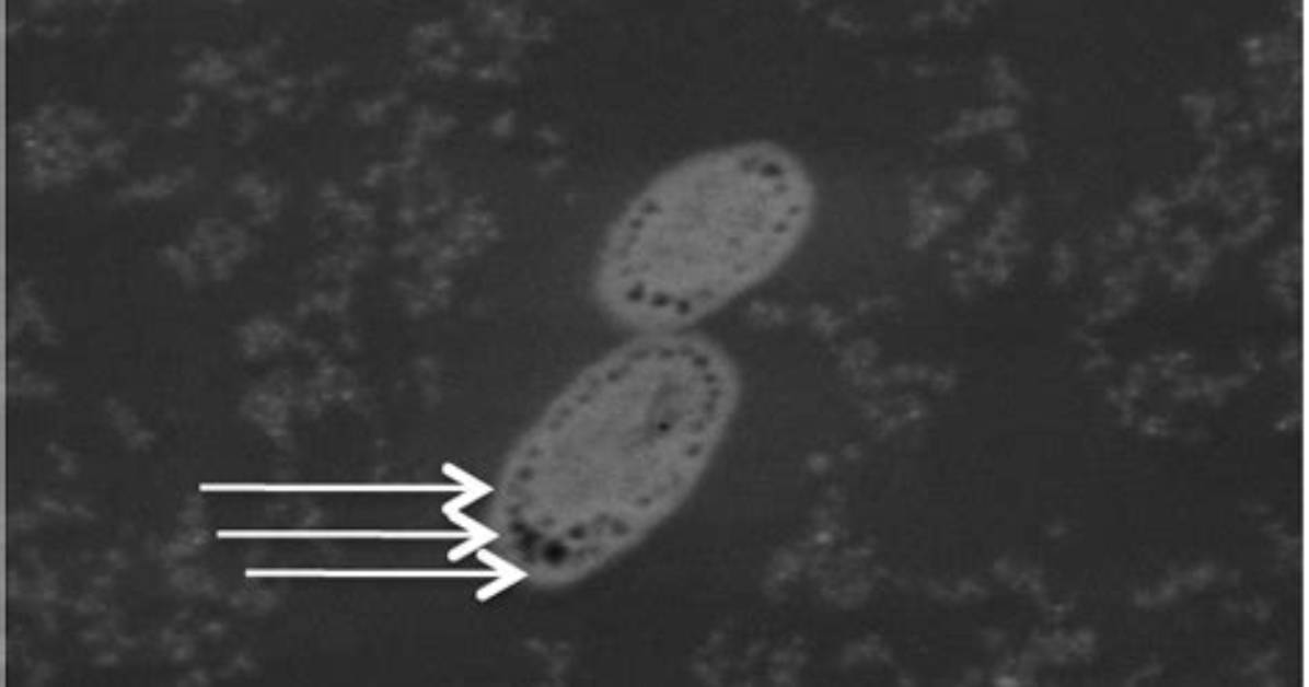 Is E Coli Encapsulated?