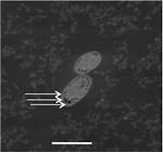 Is E Coli Encapsulated?