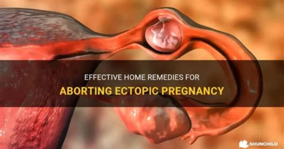 Is Ectopic Pregnancy Aborting?