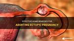 Is Ectopic Pregnancy Aborting?