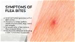 Is Flea Bites Contagious?