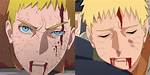 Is Guy Dead Naruto?
